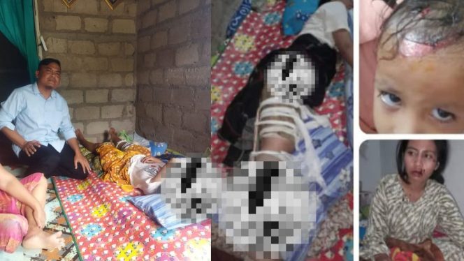 
					Korban Tabrak Lari di Desa Bakti, Anggota DPRD Gerindra Turun Tangan